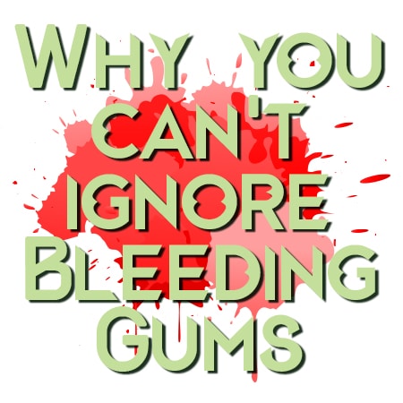 Chisholm Trail Dental explain why you should be concerned with bleeding gums