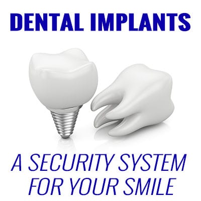 Benbrook dentist, Drs. Cindy & Ryan Knight at Chisholm Trial Dental shares the benefits of dental implants for your oral and overall health.