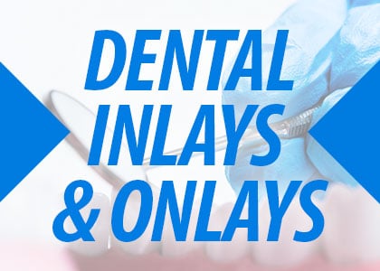 Dental inlays & onlays